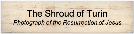 The Shroud of Turin - Photograph of the Resurrection of Jesus 